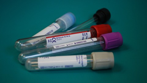 Oppositie neemt kabinetsbeleid vaccinatie onder vuur